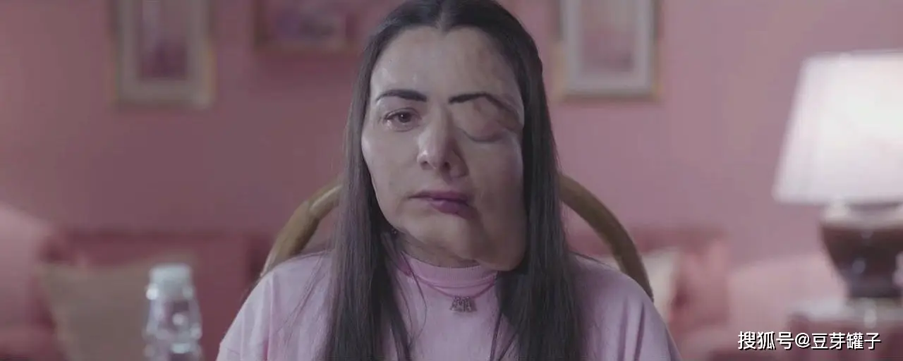 肌肤_肌肤之亲_肌肤饥渴症是真的吗